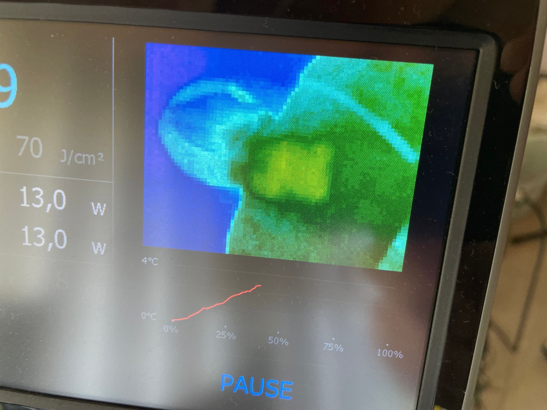 Eine Nahaufnahme eines Computerbildschirms mit einer Pause-Taste