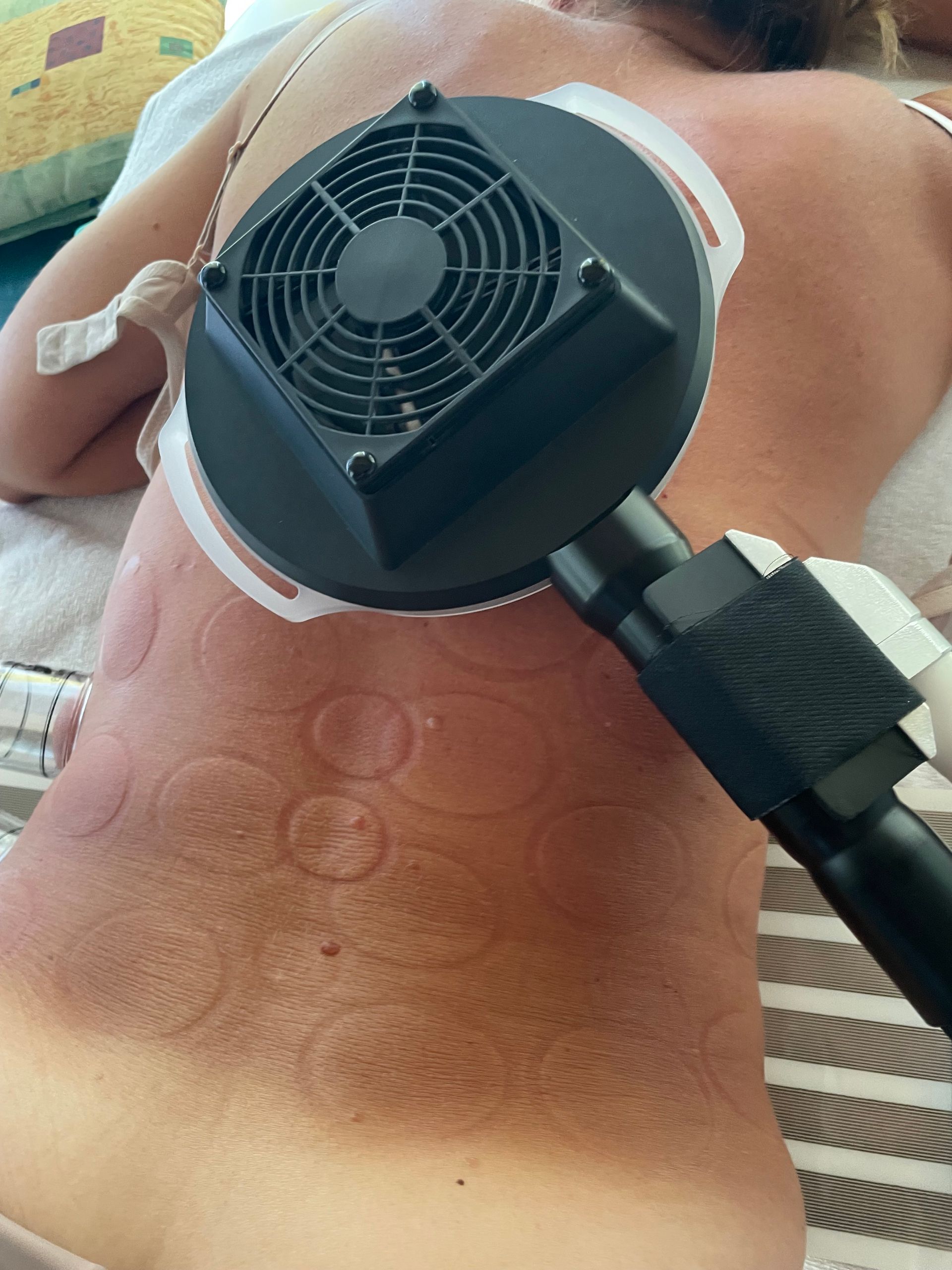 Eine Frau bekommt eine Massage mit einem Fächer auf dem Rücken