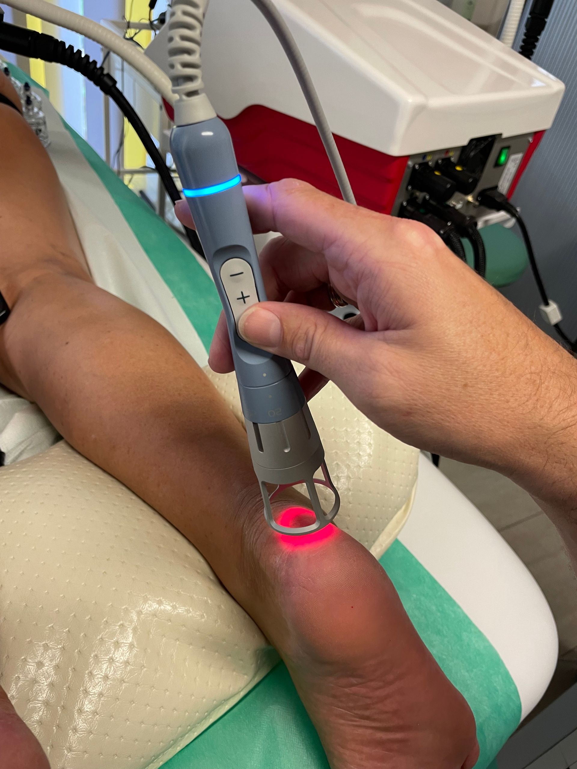Eine Person erhält eine Laserbehandlung am Handgelenk