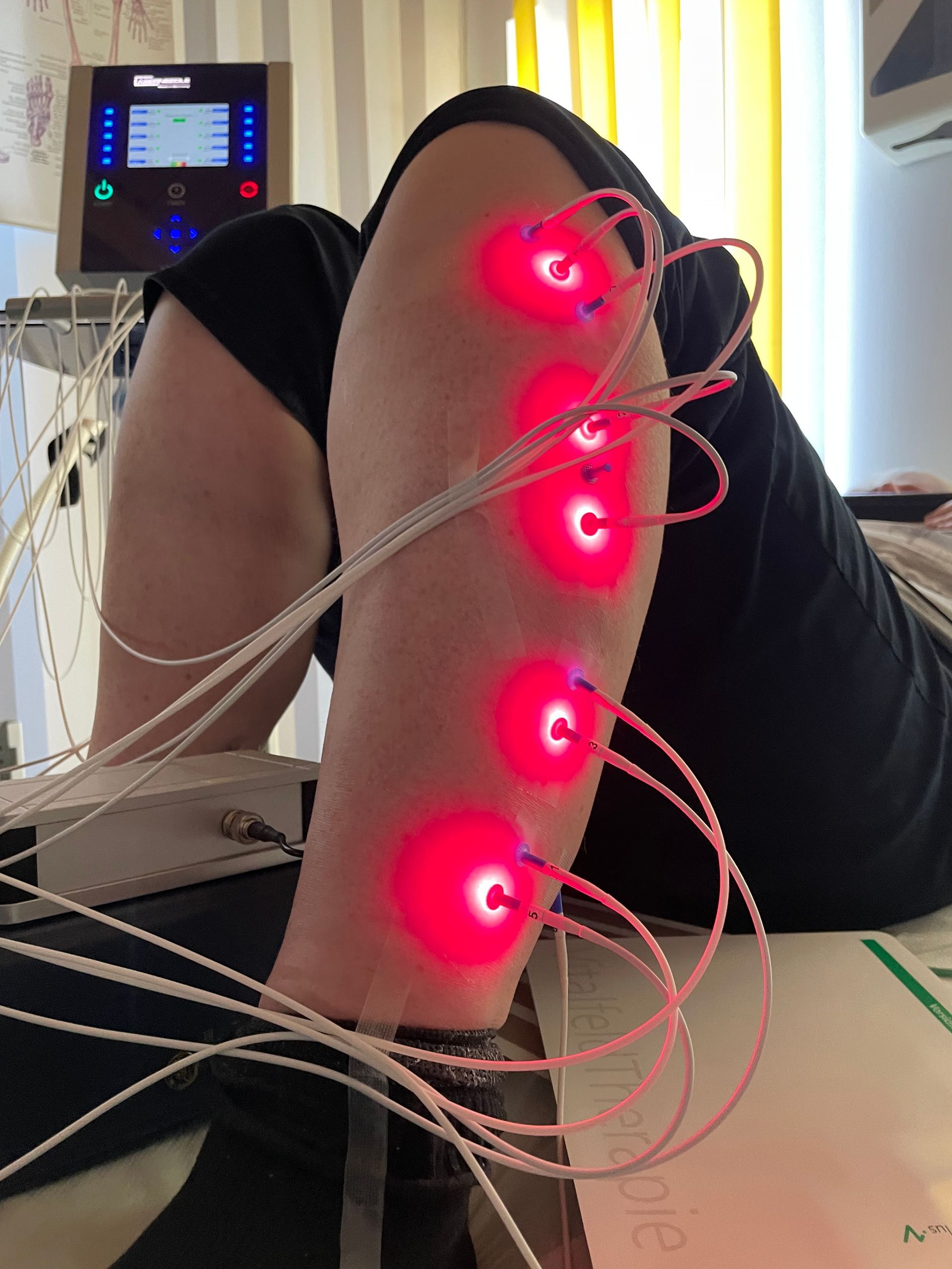 Eine Person, die mit roten Lichtern an ihrem Bein auf einem Bett liegt