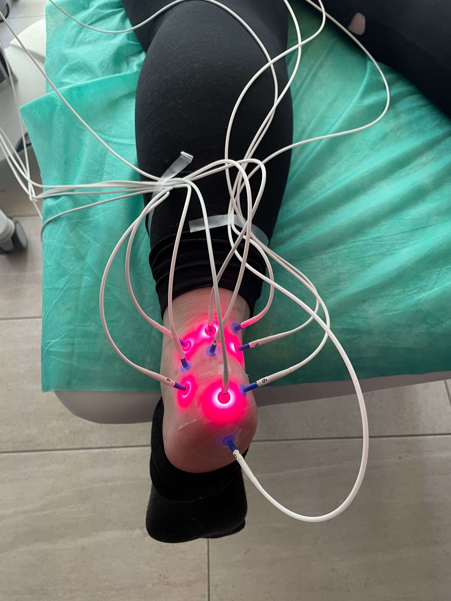 Eine Person, die auf einem Bett liegt und an deren Fuß ein Bündel Drähte angeschlossen sind