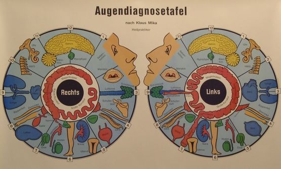 Ein Diagramm der Augen einer Person mit dem Wort Augendiagnosetafel darauf