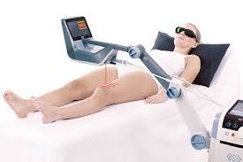 Eine Frau liegt auf einem Bett und bekommt eine Laserbehandlung an ihrem Bein.