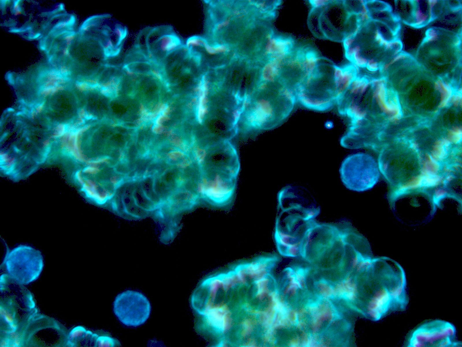 Eine Nahaufnahme einer Reihe blauer Blasen auf schwarzem Hintergrund.