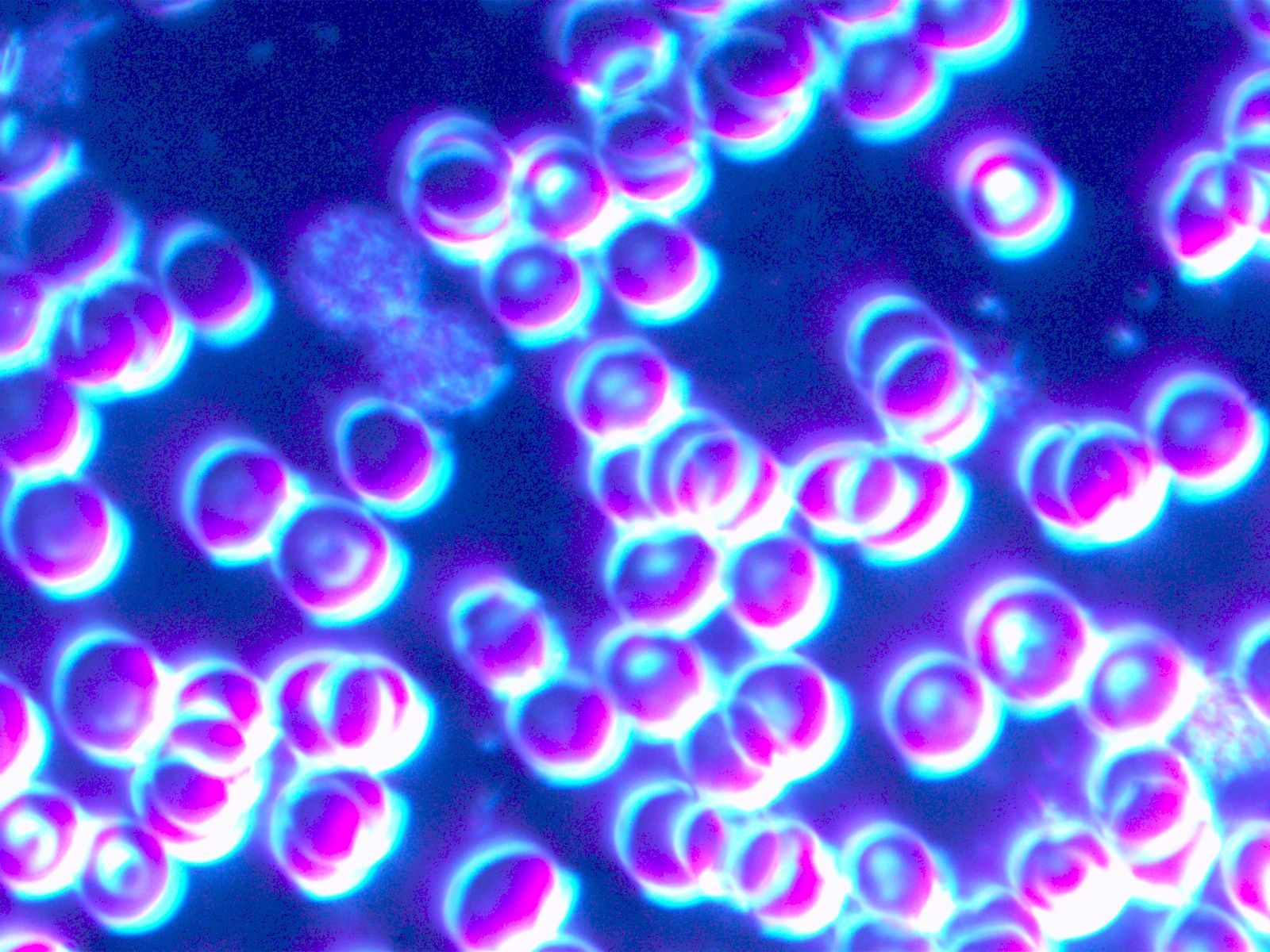 Mikroskopbild von Blut