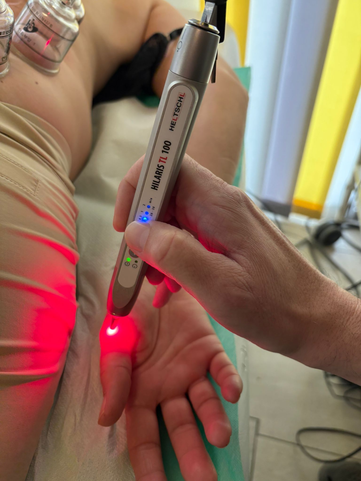 Eine Person benutzt einen Laserstift auf der Hand einer anderen Person