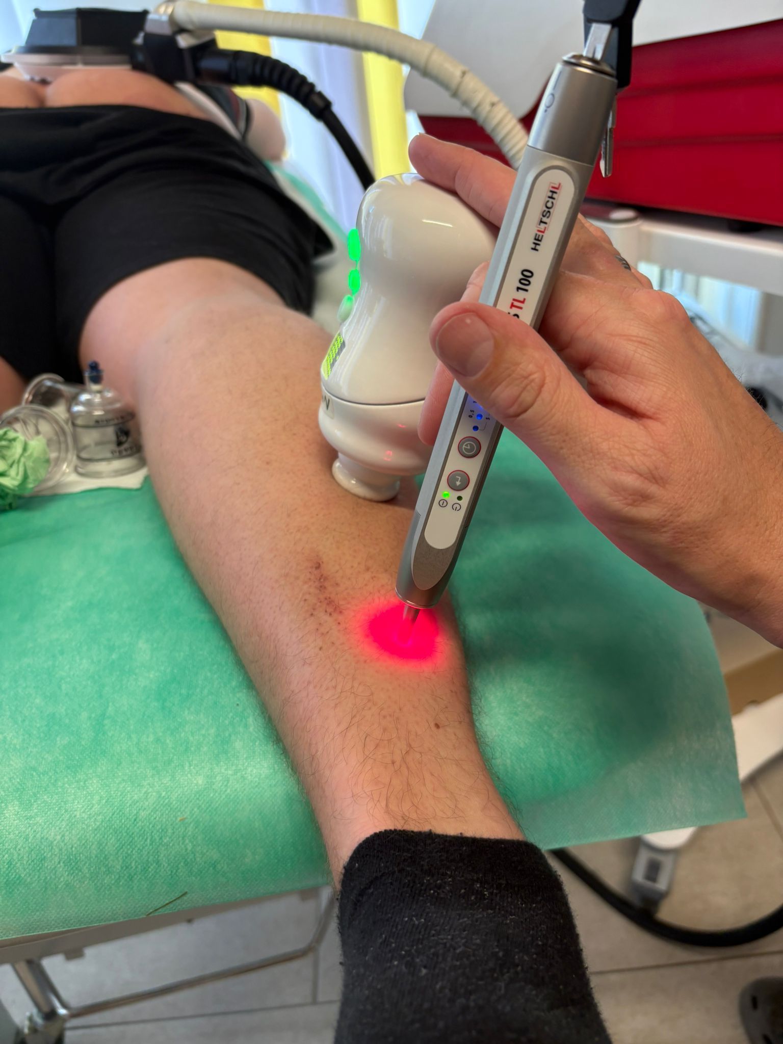 Eine Person erhält eine Laserbehandlung am Bein.