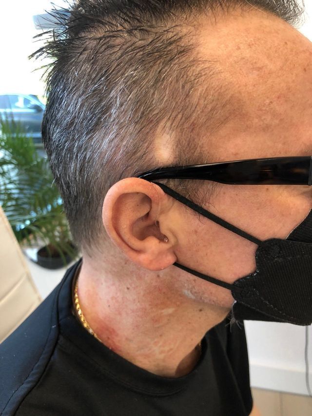 Kunde der Hören in Kreuzlingen GmbH mit Hörgerät