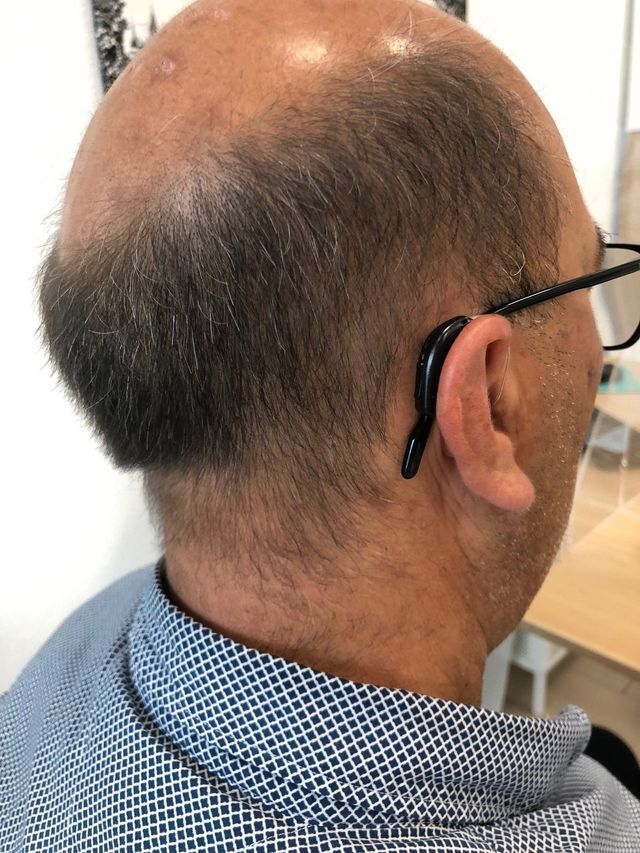Kunde der Hören in Kreuzlingen GmbH mit Hörgerät