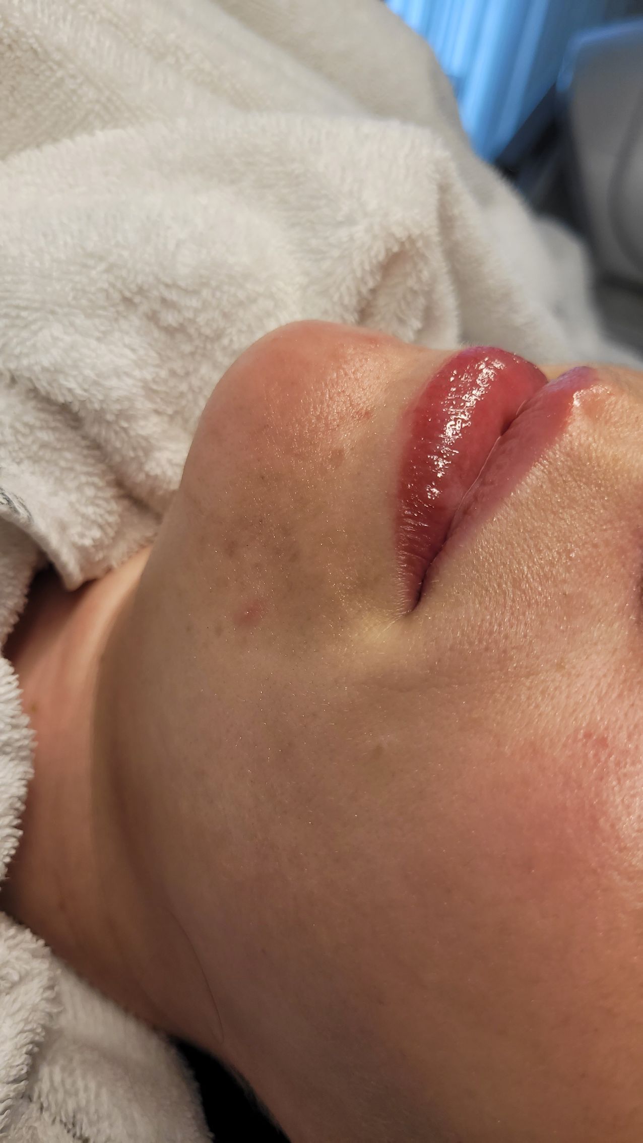 Nahaufnahme von glänzenden Lippen und Kinn einer Person, die auf einem weißen Handtuch ruhen.