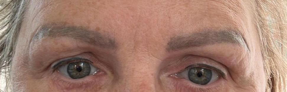 Nahaufnahme der Augen und des oberen Gesichts einer Person mit sichtbaren Falten und grauen Haaren