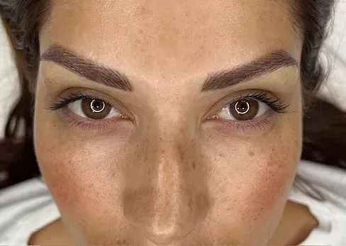 Un primer plano del rostro de una mujer con ojos marrones y pecas.
