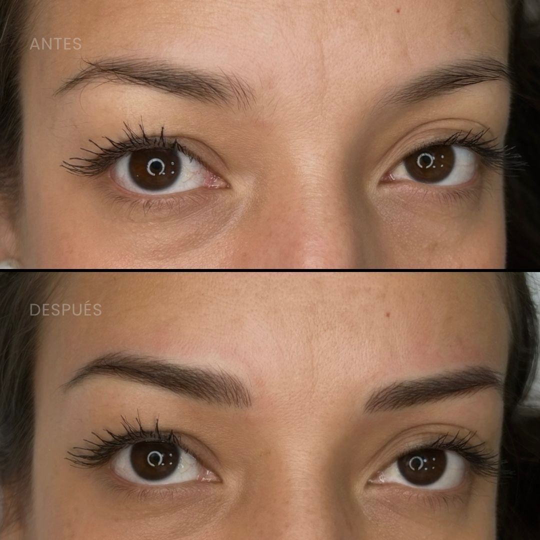 Fotos de antes y después: contorno de ojos. Arriba: cejas dispersas. Abajo: cejas más pobladas, definidas y oscuras.