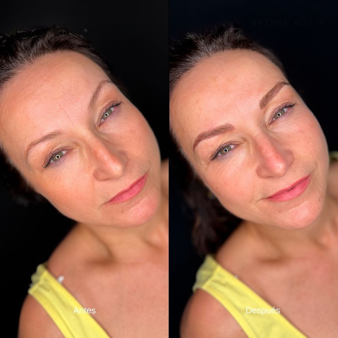 Fotografías de antes y después, una al lado de la otra, de las cejas de una mujer, después del microblading.