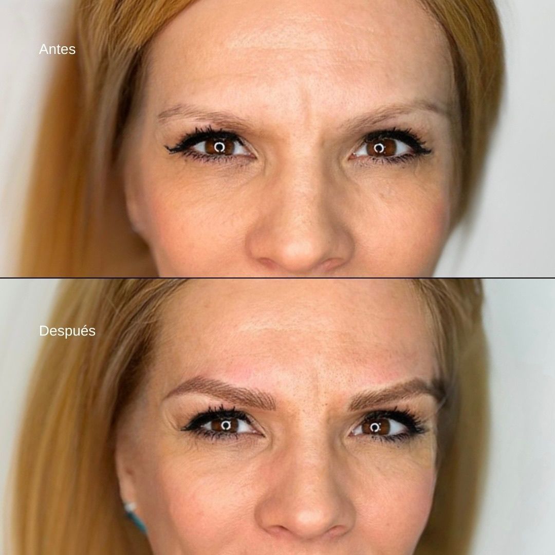 Antes y después de las cejas: Las cejas de una mujer se transformaron de escasas a rellenas con microblading.