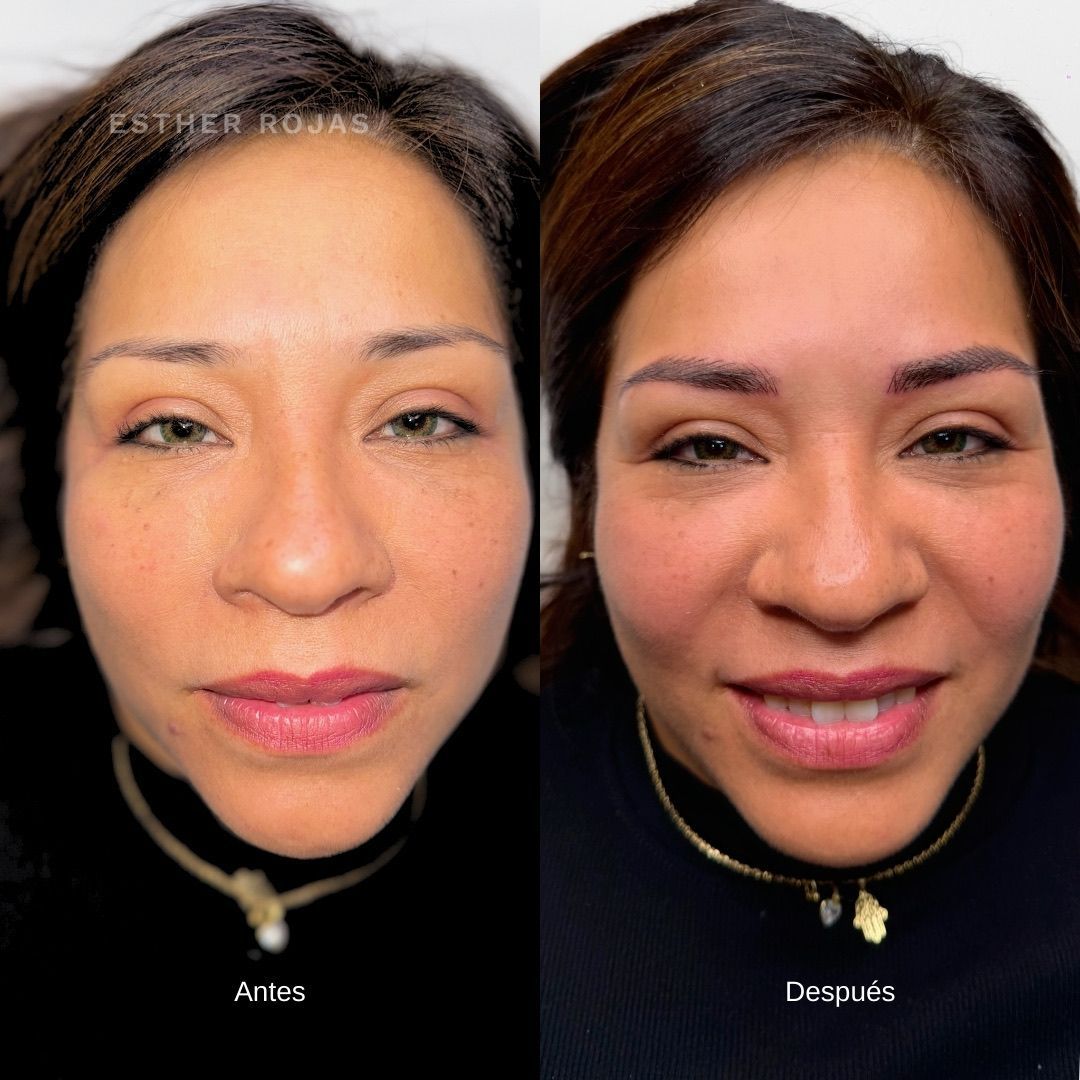 Foto de antes y después del rostro de una mujer con tatuaje en las cejas. La foto del después muestra cejas más pobladas y oscuras.