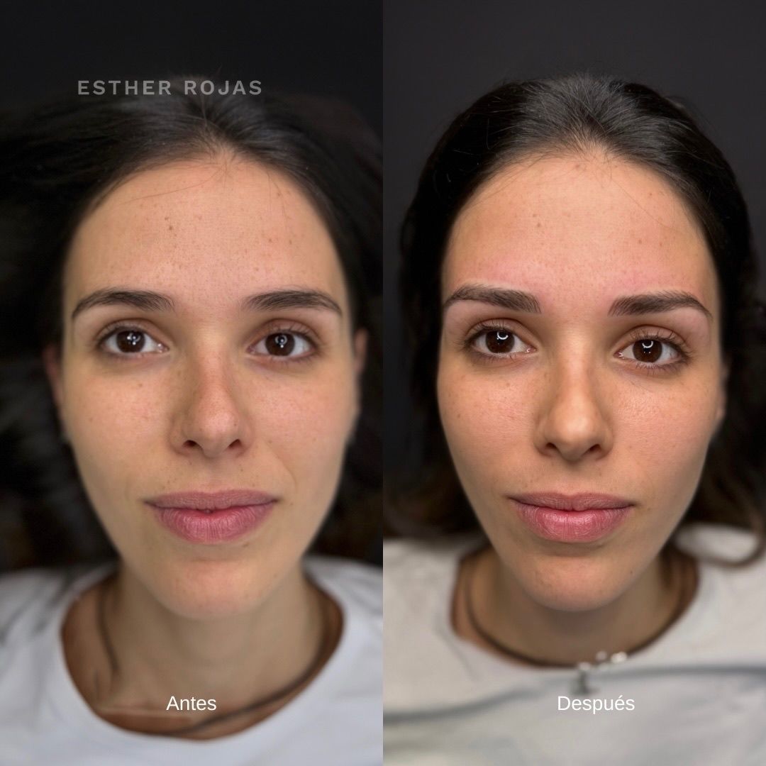 Fotografías de antes y después de una mujer con aumento de cejas; cejas color marrón oscuro, piel clara.