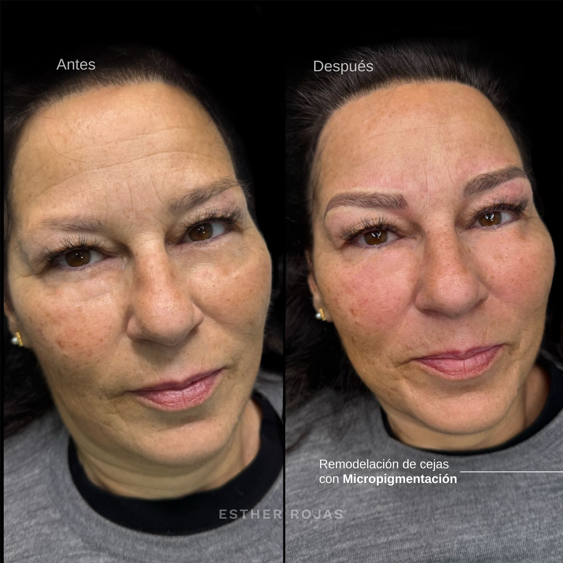 Fotos antes y después: cejas de mujer remodeladas con micropigmentación.