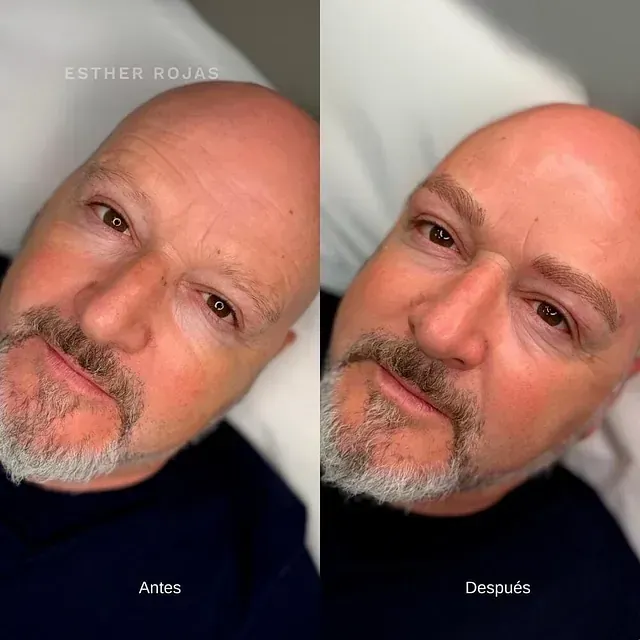 Una foto de antes y después de un hombre con barba.