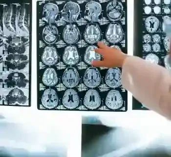 Médico apontando para exames de imagem do cérebro exibidos em um painel luminoso, com radiografias dos ossos abaixo.