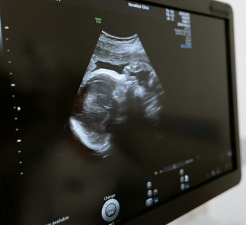 Imagem de ultrassom mostrando um feto em perfil, em um ambiente médico.