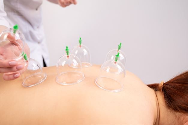 Persona que recibe terapia de ventosas en la espalda, con ventosas transparentes colocadas, practicante con bata blanca.