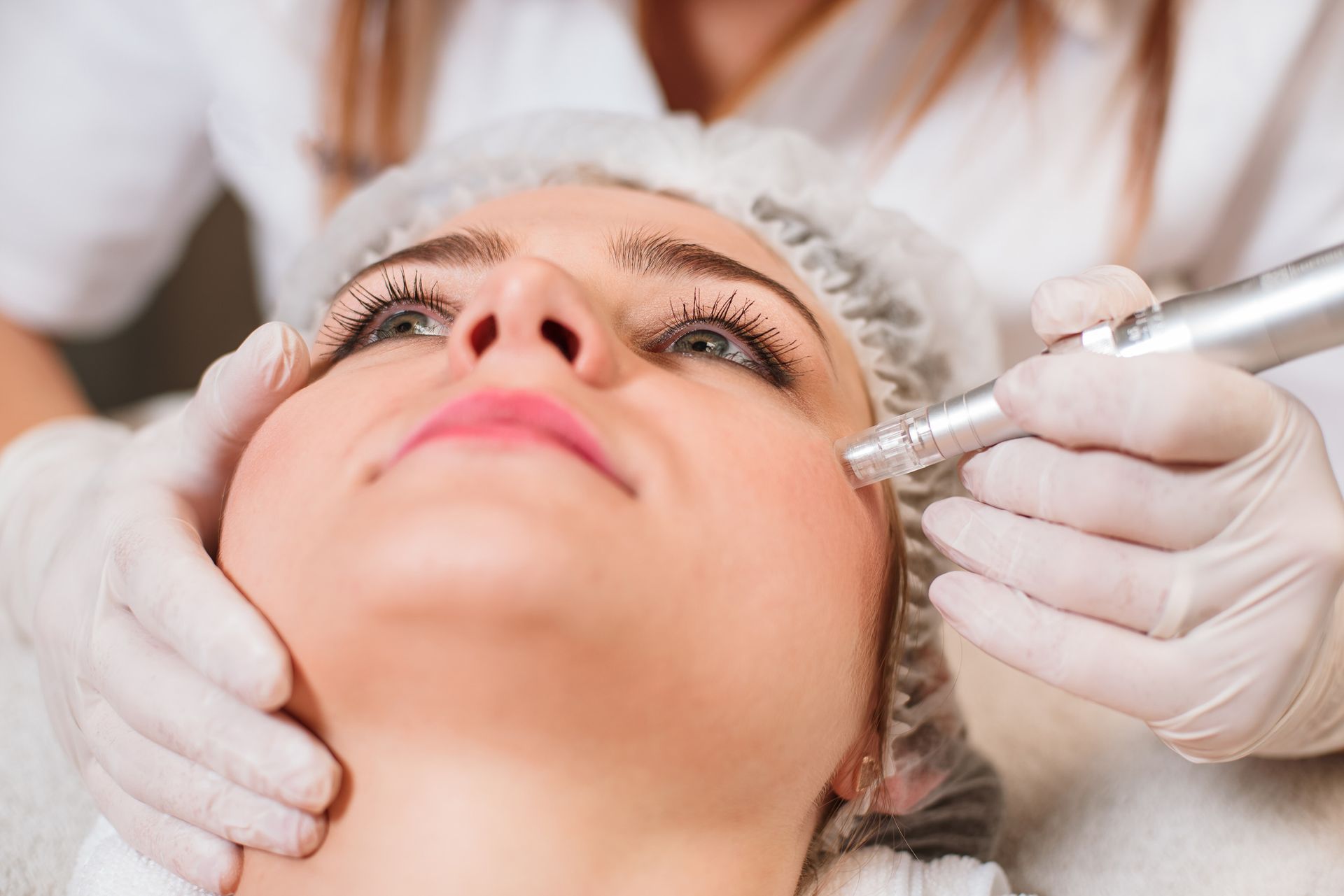Una mujer está recibiendo un tratamiento de microdermoabrasión en su cara.
