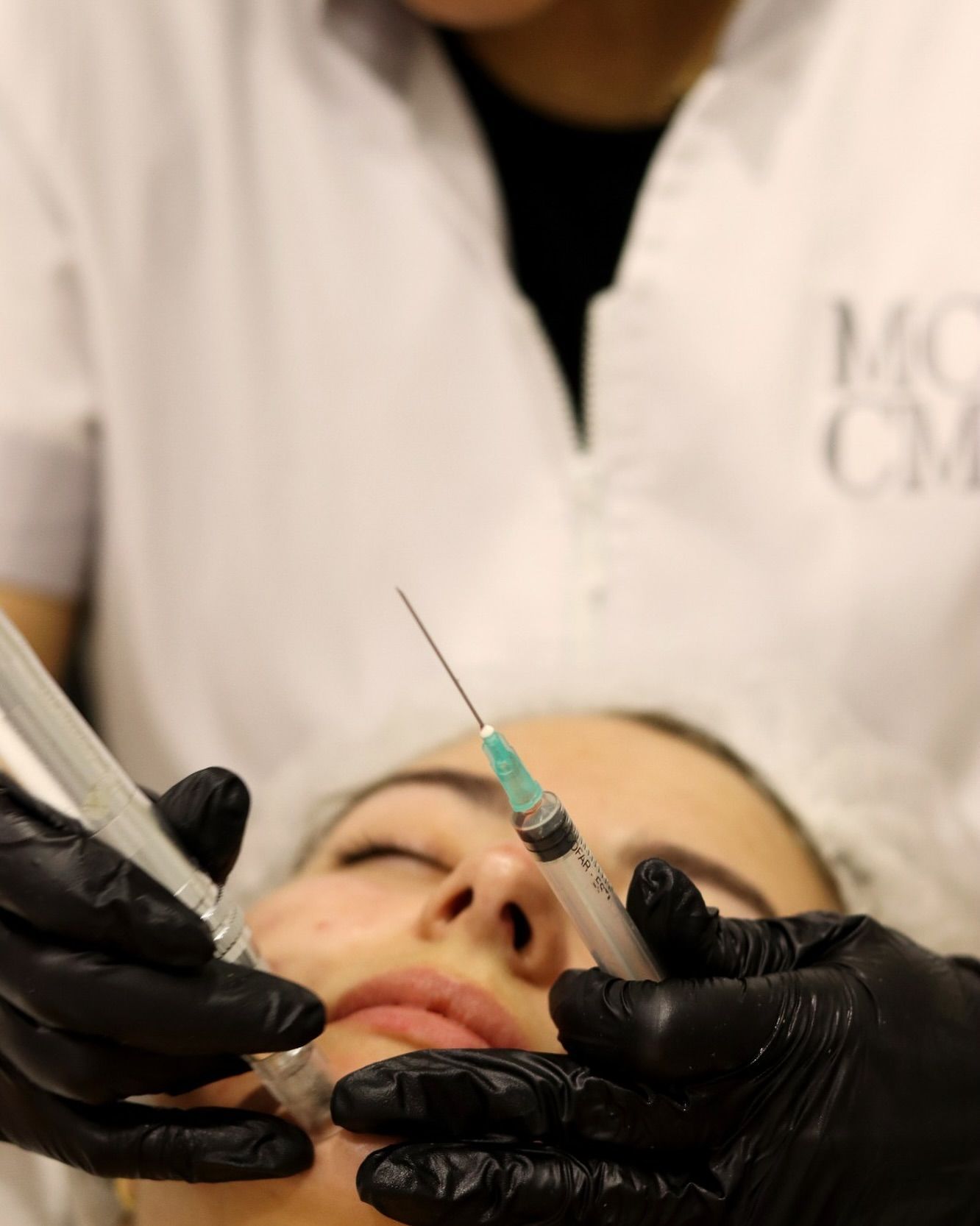 Una mujer recibe una inyección de botox en la cara.