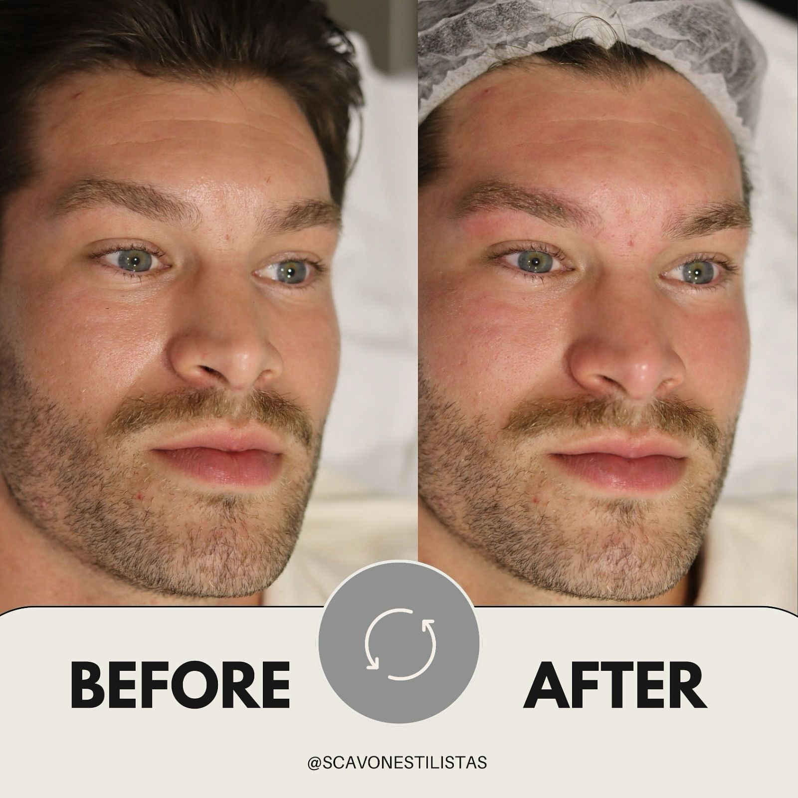Una foto de antes y después de la cara de un hombre.