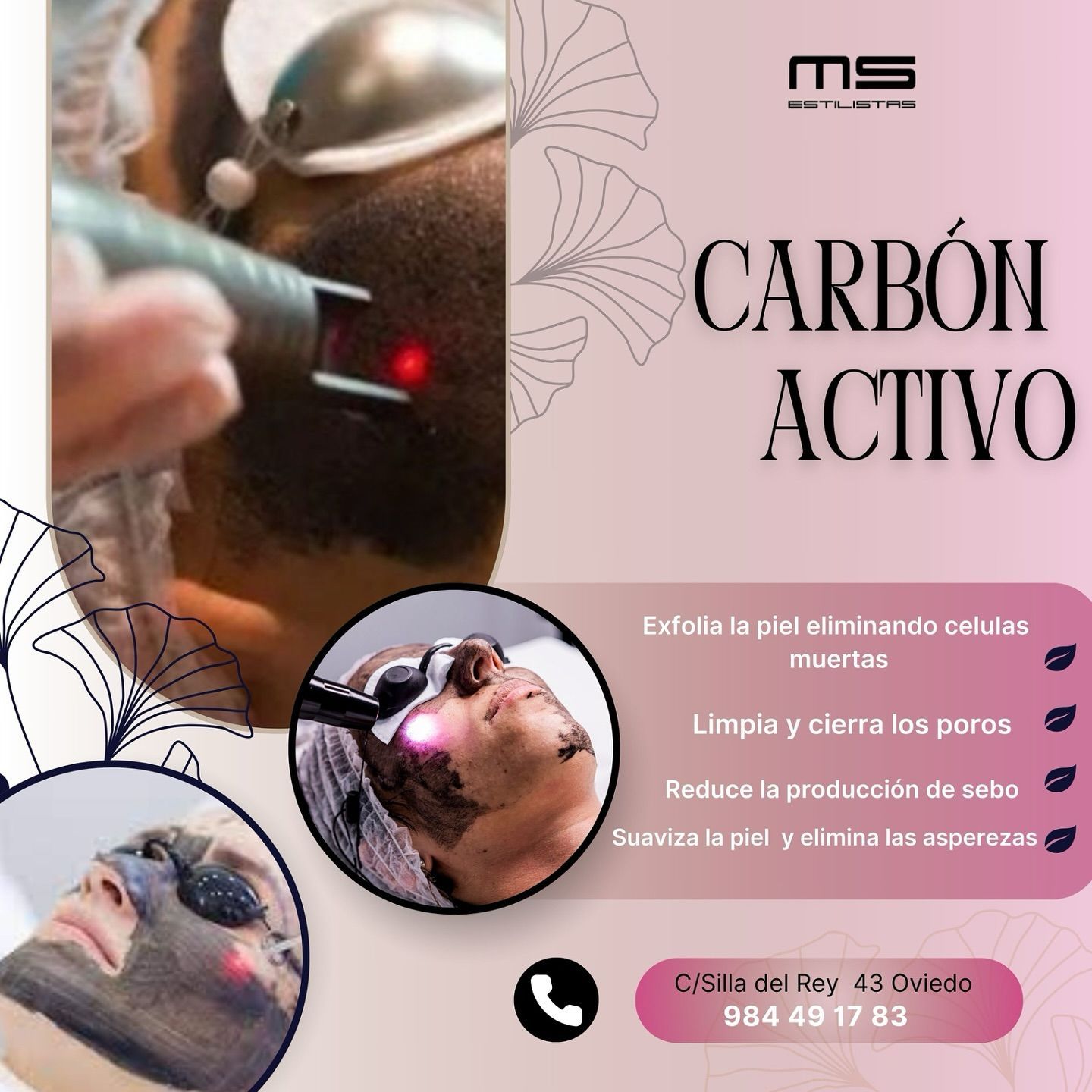 Un hombre está recibiendo un tratamiento de carbón activo en su cara.