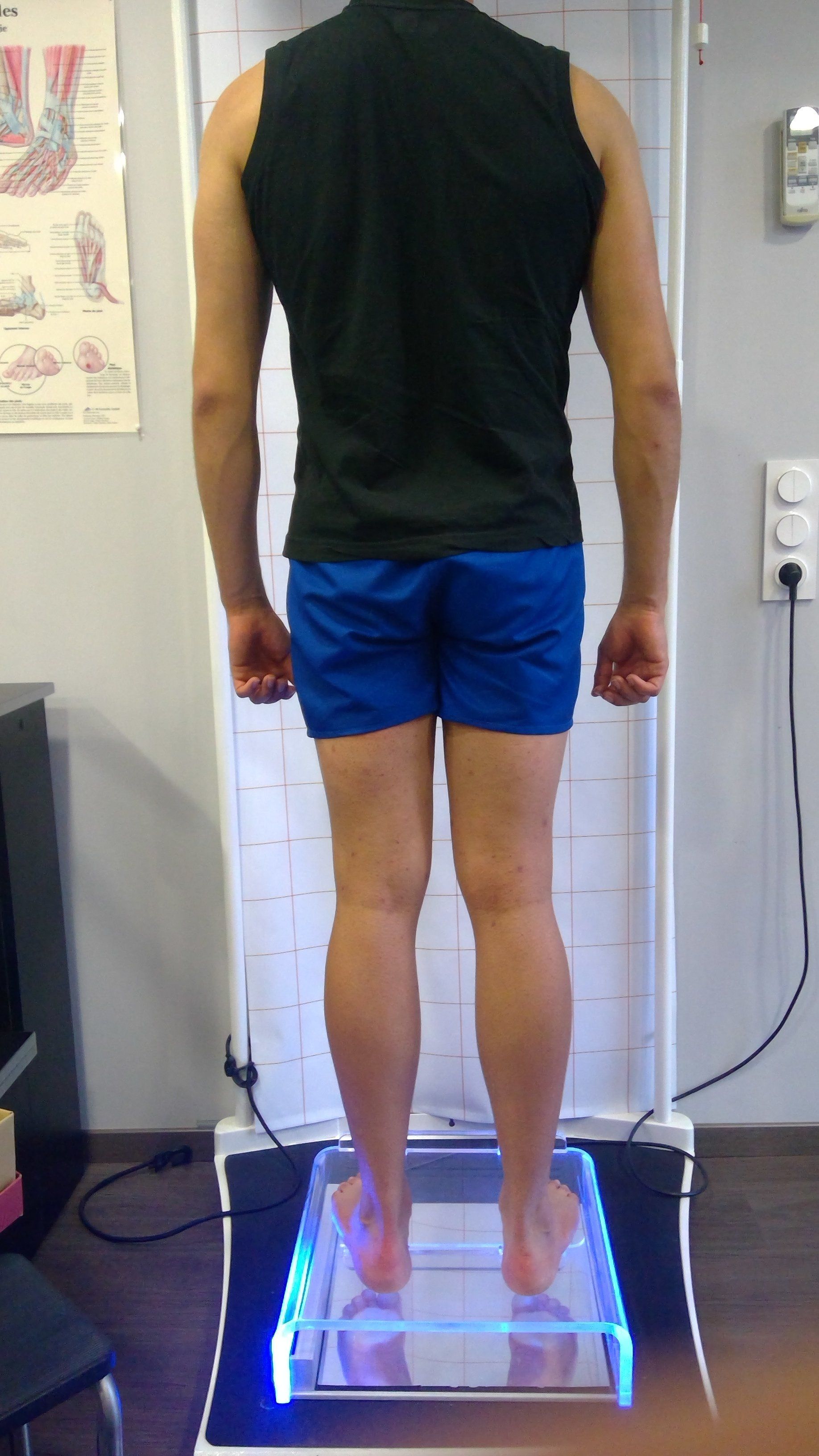 Analyse sur podoscope de la statique