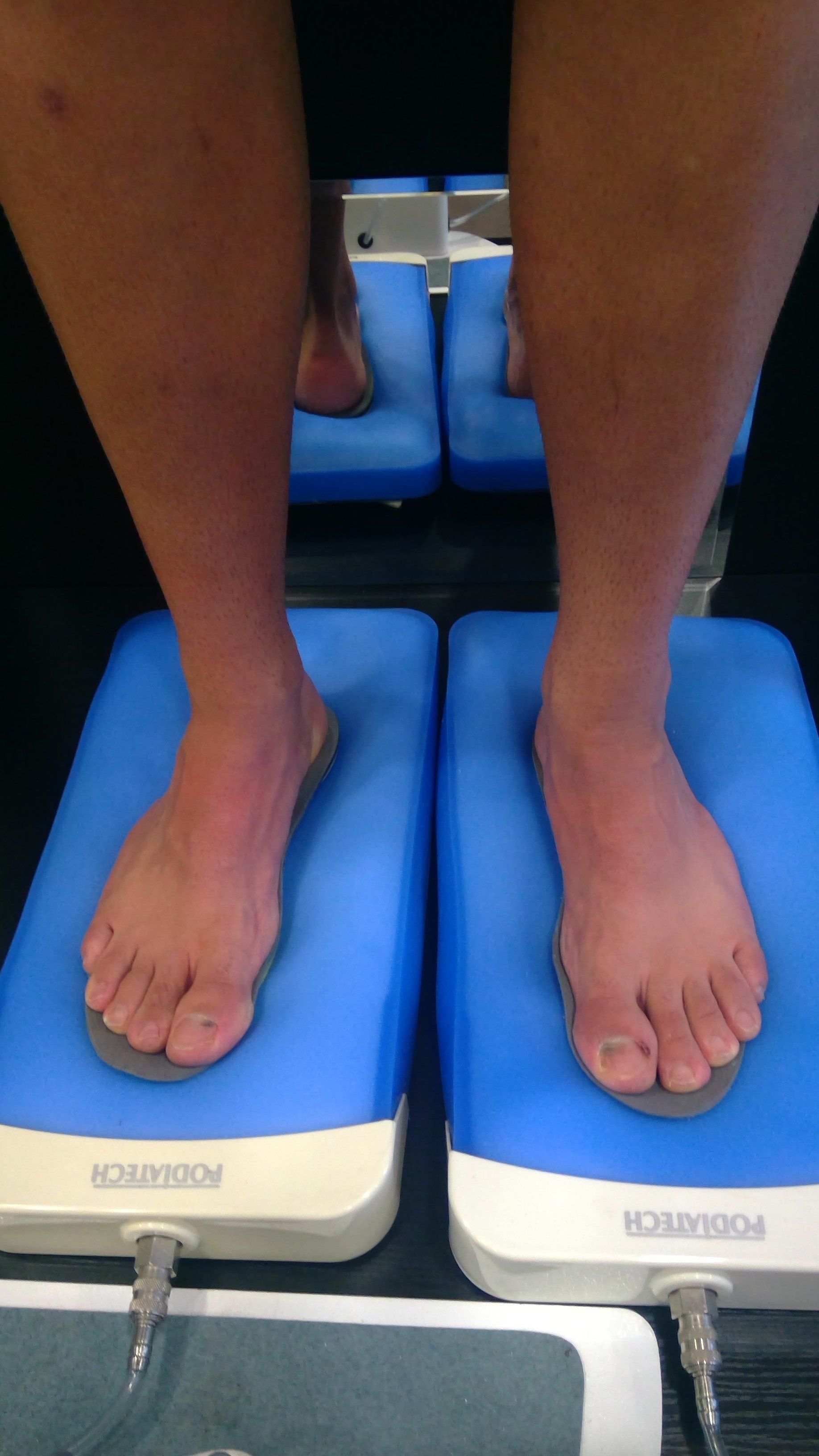 Thermo-formage des semelles