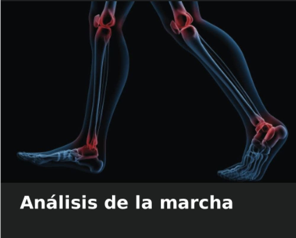 Una imagen de las piernas de una persona con las palabras análisis de la marcha debajo.