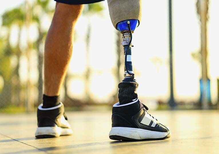 Un hombre con una pierna protésica está parado en una acera.