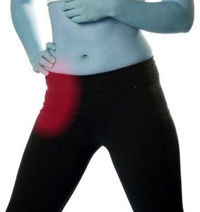 Nivelrikko