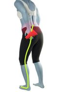 Piriformis