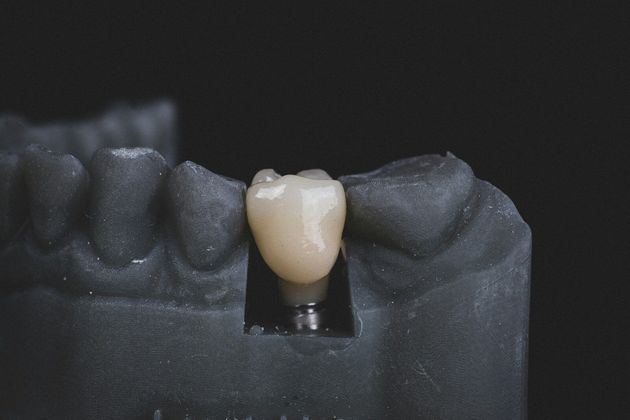 Des mains utilisent un outil pour travailler sur un modèle dentaire avec des dents artificielles.