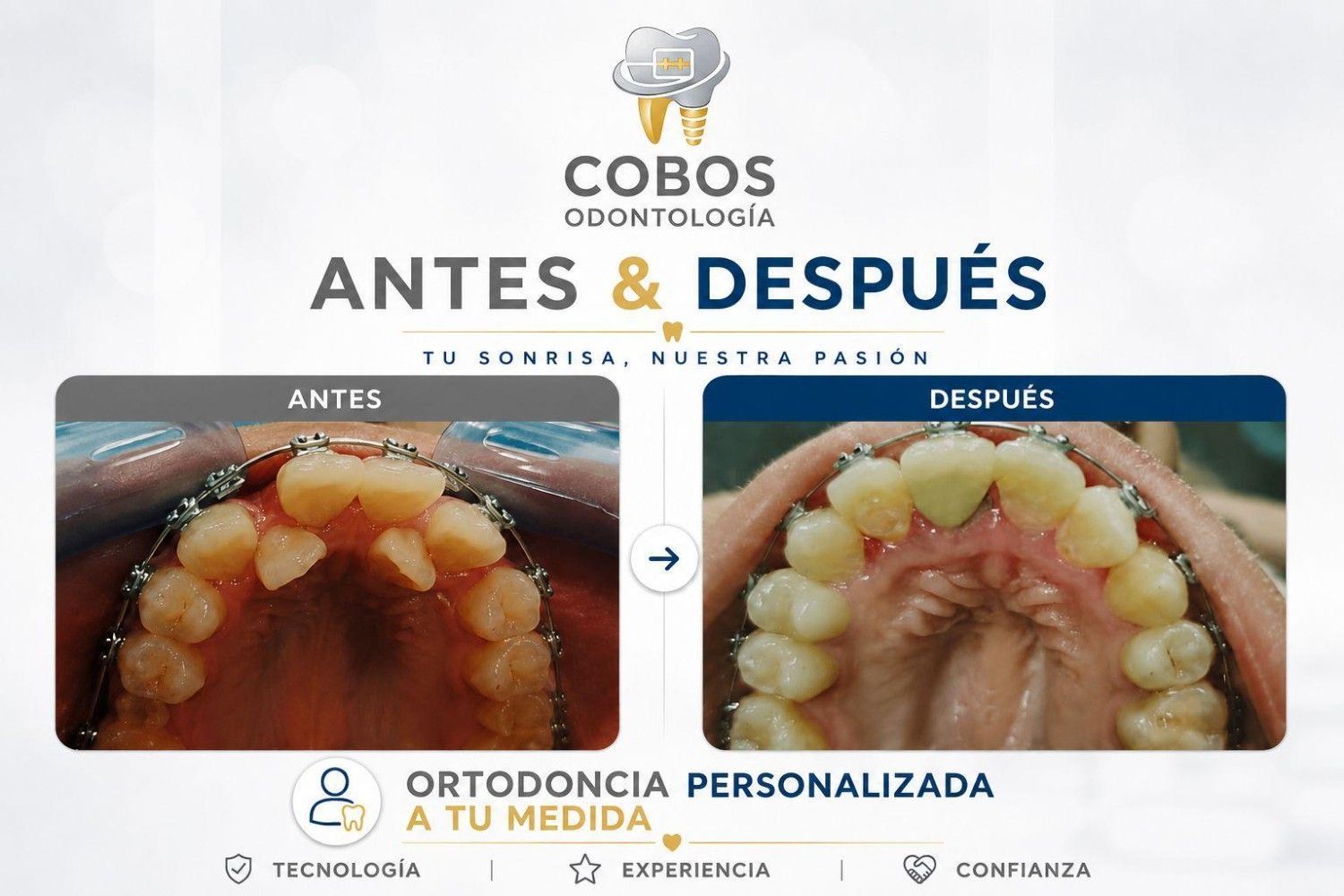 Manos enguantadas sosteniendo un modelo dental con dientes rojos y blancos durante una demostración de examen dental.
