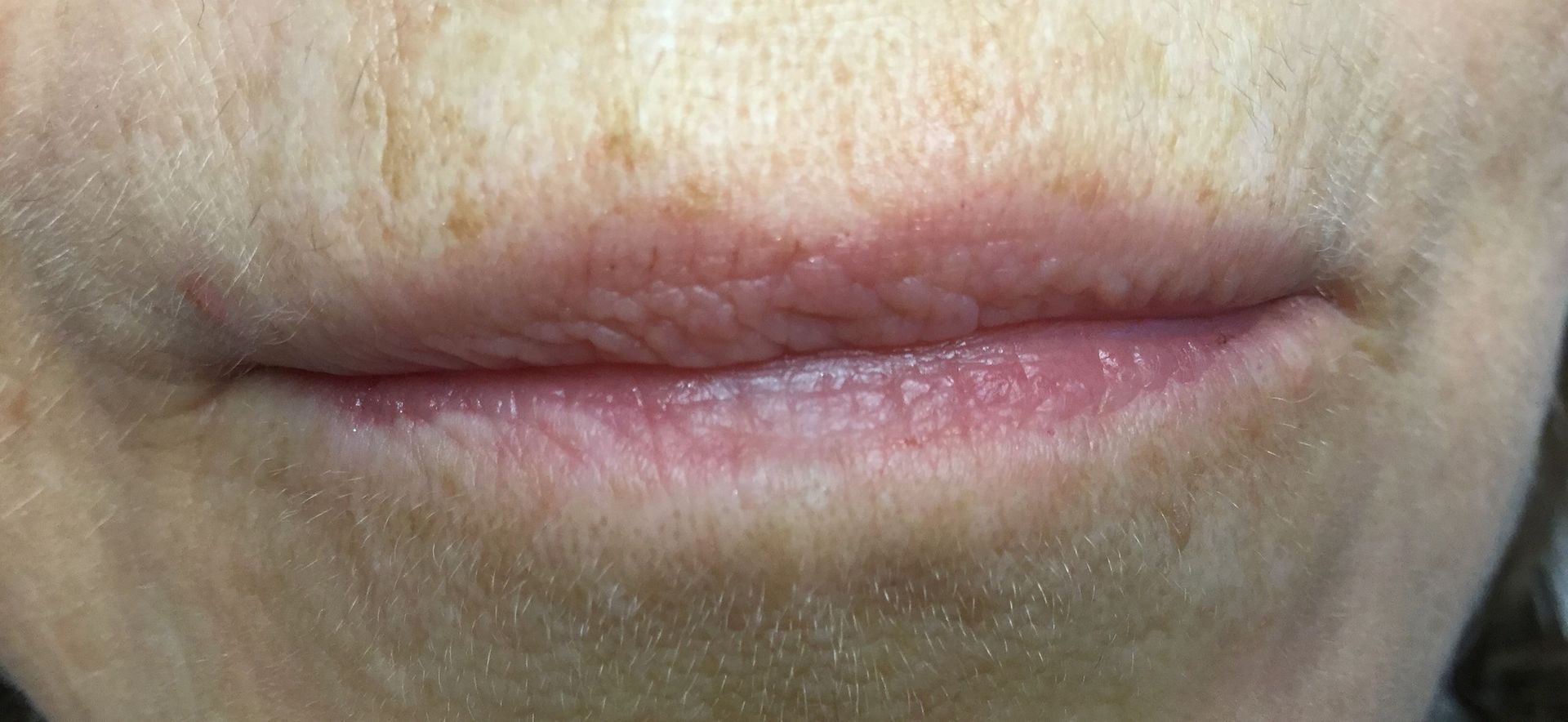 nos-medias-galerie-photos-institut-de-beaute-valere-sion-valais