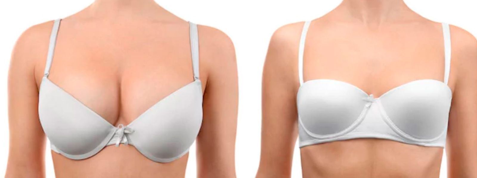 dos mujeres con brasier diferente talla