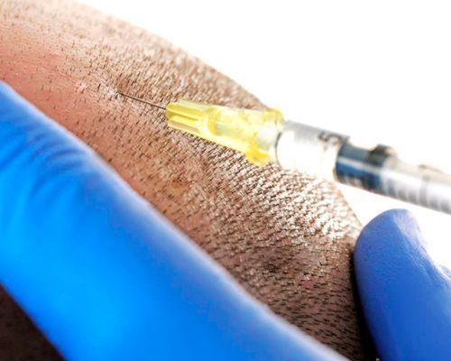 Una persona recibe una inyección en el brazo con una jeringa.
