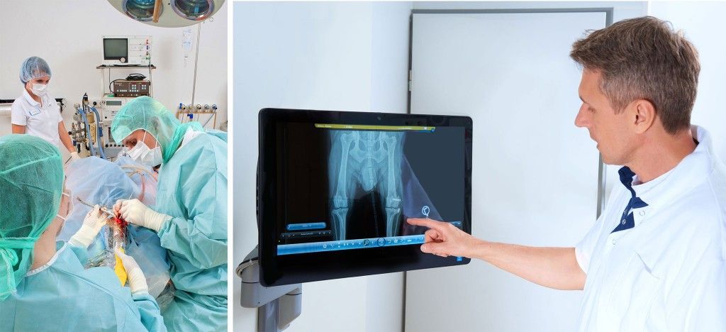 Ein Chirurg zeigt auf eine Röntgenaufnahme auf einem Monitor, während eine Gruppe von Chirurgen eine Operation durchführt.