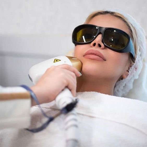 Une femme portant des lunettes de sécurité reçoit un traitement laser pour la peau du visage.