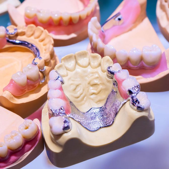 teinte dentaire - Zahnlabor