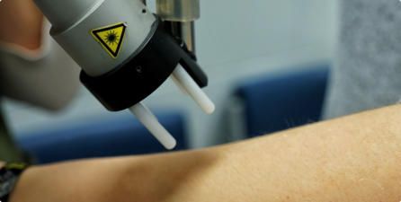 Auf einen Arm gerichtetes Lasergerät. Das Gerät ist silberfarben und mit einem Warnsymbol versehen.