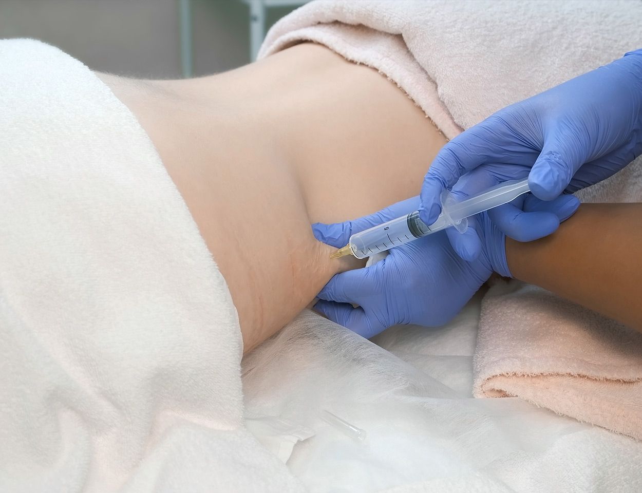 Injection d'un liquide sous la peau d'un patient