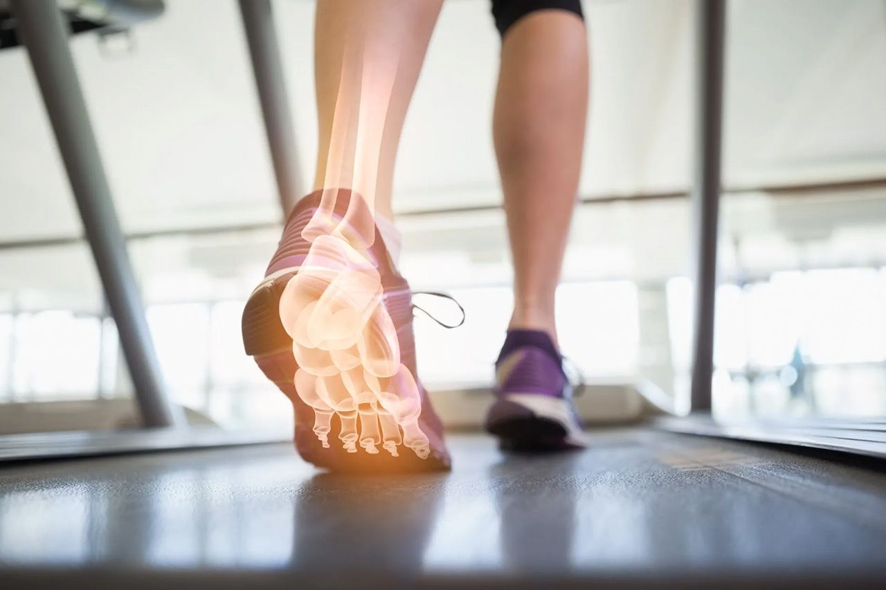 Analyse de la marche