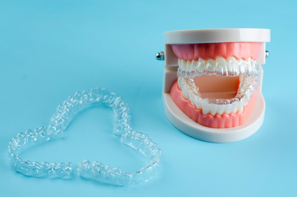 Un modelo de dientes con aparatos transparentes sobre un fondo azul.