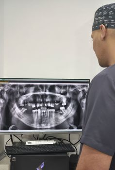 Un hombre con barba se ríe con la boca abierta