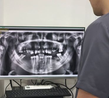 Una mujer se está blanqueando los dientes con un dentista.